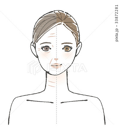 顔　ビフォーアフター　イラスト 33872281
