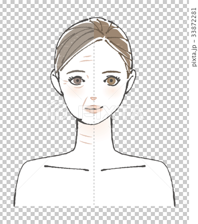顔　ビフォーアフター　イラスト 33872281