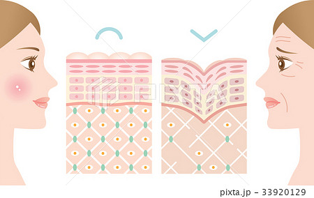若い肌　しわ肌　断面図 33920129