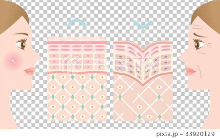 若い肌　しわ肌　断面図 33920129