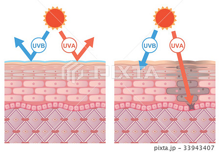 肌断面(しみ) 肌断面(しみ) 33943407