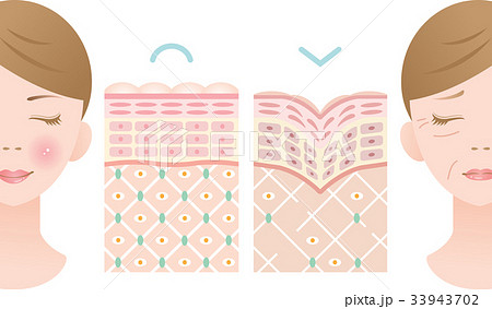若い肌　しわ肌　断面図 33943702