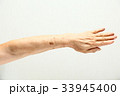 シニア女性の腕のシミ 33945400