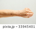 シニア女性の腕のシミ 33945401