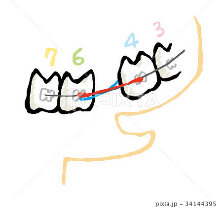 歯列 34144395