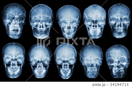 Collection of asian skull . front view . Collection of asian skull . front view . 34194713