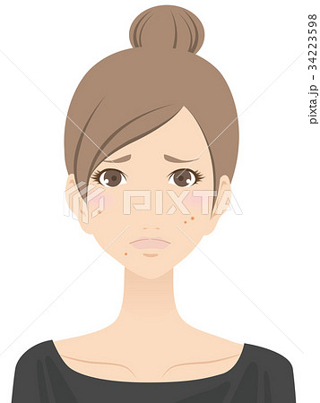 女性（にきび） 34223598