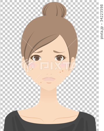 女性（にきび） 34223598