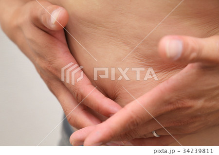 肥満 ダイエットイメージ 肥満 ダイエットイメージ 34239811