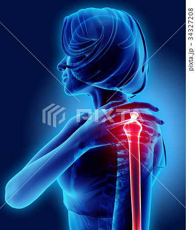Shoulder painful skeleton x-ray, 3D illustration. 34327208