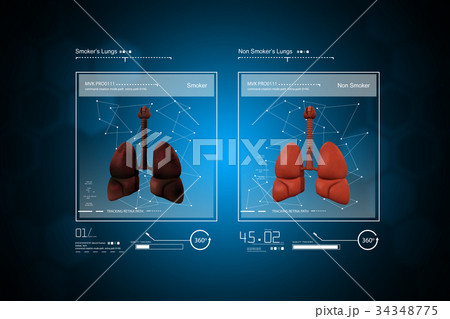 Young doctor showing lungs 34348775