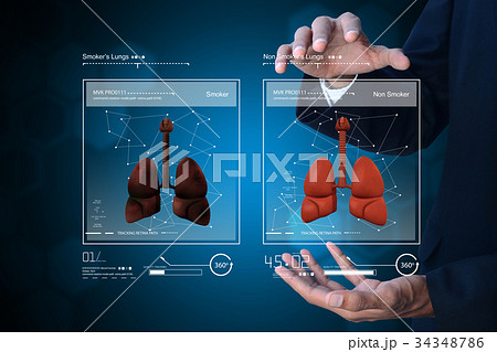 Young doctor showing lungs Young doctor showing lungs 34348786