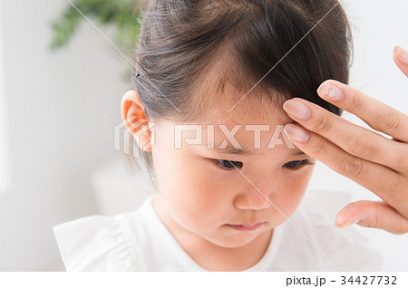 子どもの肌トラブル 34427732