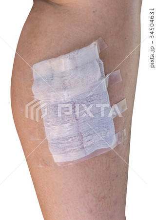 bandage on leg from Horrible burns 34504631