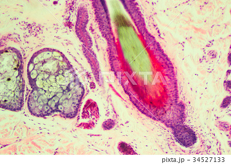 毛根 毛根 34527133