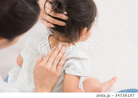 子どもの肌トラブル 子どもの肌トラブル 34536197