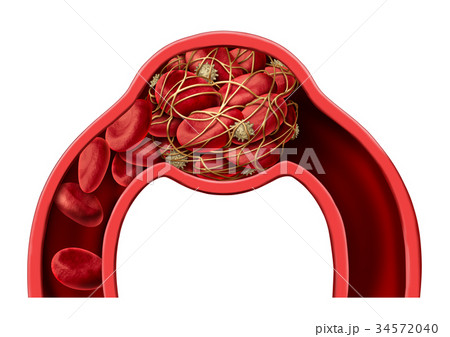 Blood Clot Disease Symbol 34572040
