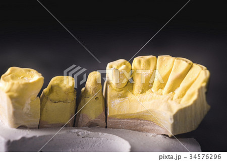 Dental Prosthesis Prosthetic Laboratory Dental Prosthesis Prosthetic Laboratory 34576296