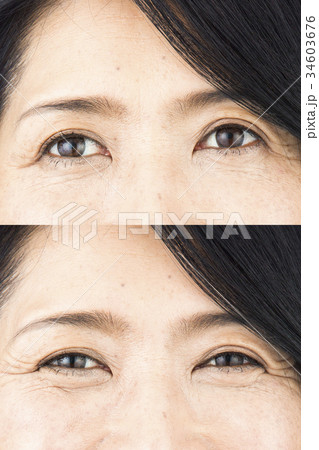 ビフォーアフターイメージ 34603676