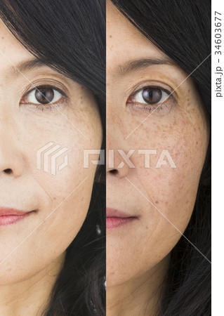 ビフォーアフターイメージ 34603677