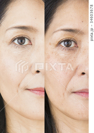 ビフォーアフターイメージ 34603678