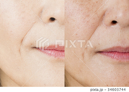 ビフォーアフターイメージ 34603744