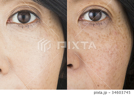 ビフォーアフターイメージ ビフォーアフターイメージ 34603745