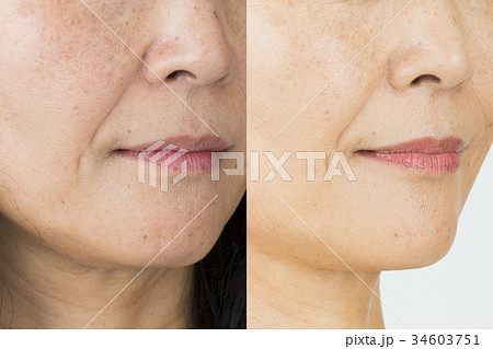 ビフォーアフターイメージ 34603751
