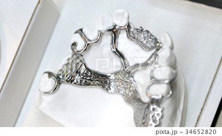 example of a bridge on an artificial human jaw example of a bridge on an artificial human jaw 34652820
