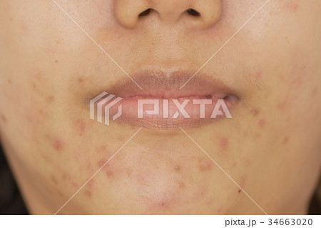 Asian women aged 25-29 years, light brown skin. 34663020