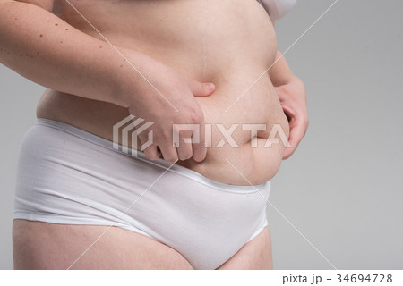 Female fat abdomen with cellulite Female fat abdomen with cellulite 34694728