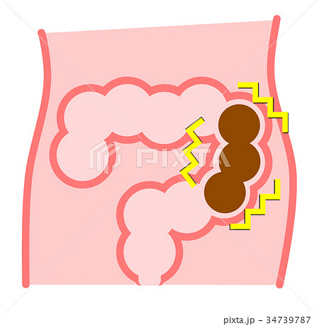腸内のイラストのイラスト素材