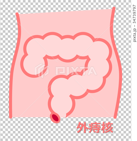 痔のイラスト 34739797