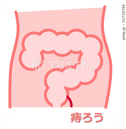 痔のイラスト 34739799