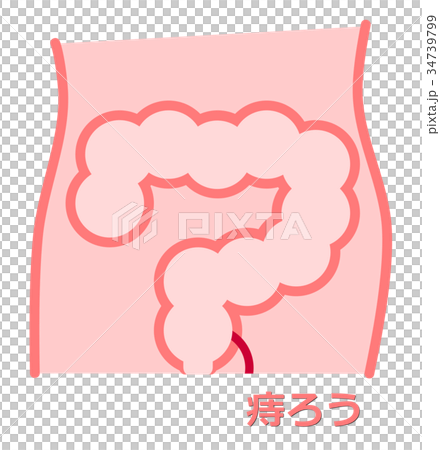 痔のイラスト 34739799
