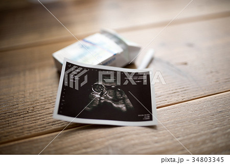 妊娠期の喫煙 妊娠期の喫煙 34803345