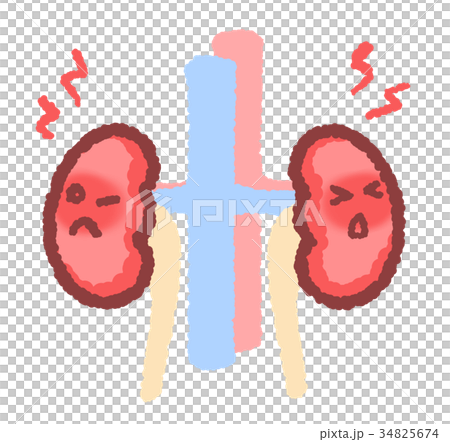 炎症を起こした腎臓　ズキズキつき 34825674