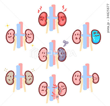 腎臓セット 34825677