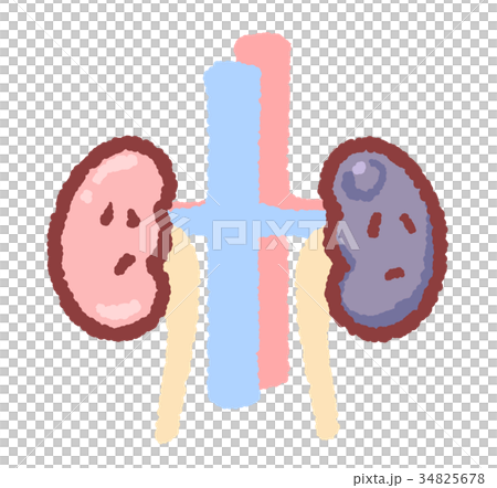Kidney with tumor 34825678