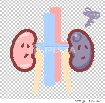 腫瘍ができた腎臓　グルグルつき 34825679