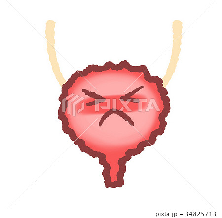 炎症を起こした膀胱 34825713