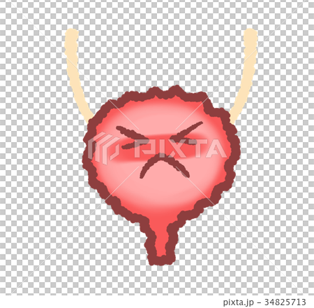 炎症を起こした膀胱 34825713