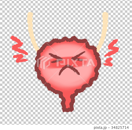 炎症を起こした膀胱　ズキズキつき 34825714