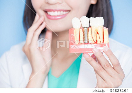 woman dentist take implant tooth 34828164