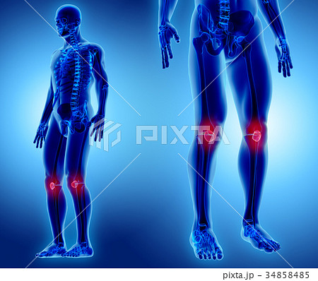 3D illustration of Patella, medical concept. 34858485