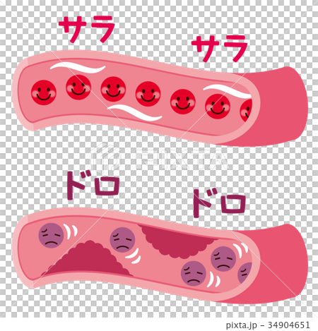 血管の断面　血液の流れ　医療 34904651