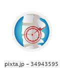 herniated disc 34943595