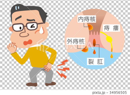 痔　男性　イラスト 34956505
