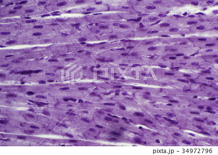 心筋（横紋筋） 34972796