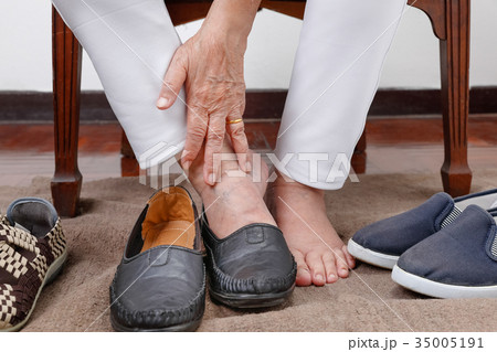 Elderly woman putting on shoes wrong feet Elderly woman putting on shoes wrong feet 35005191